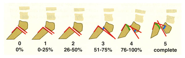 infographic