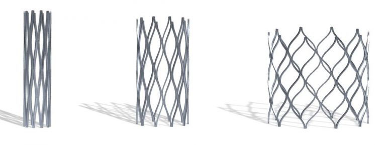 The Renata Minima Stent can be gradually expanded up to adult size over the course of the child&rsquo;s lifetime