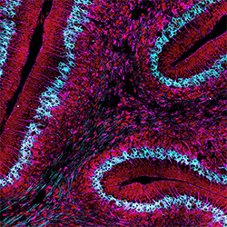 bergmann glia