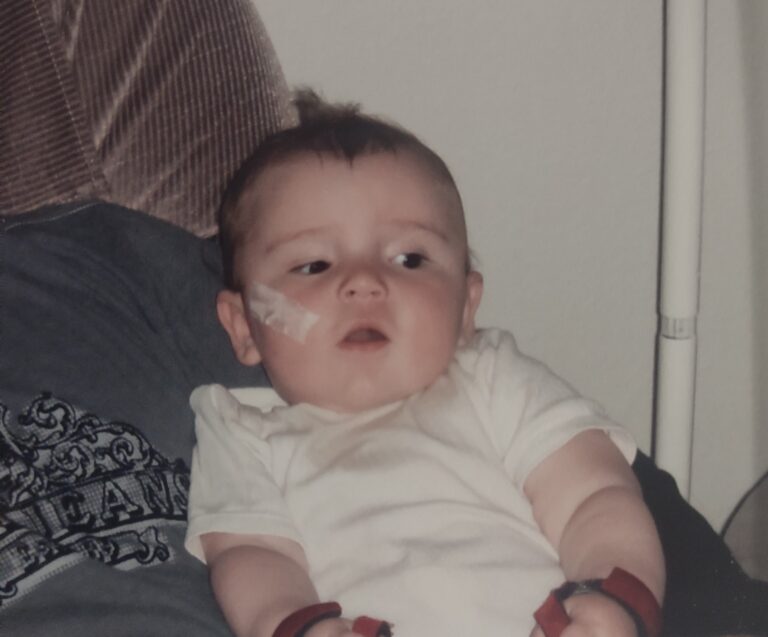 As an infant, Stage was diagnosed with a life-threatening diagnosis which causes significant muscular and neurological problems. Uncompensated Care at Seattle Children&rsquo;s, funded by generous donors, helped his family focus on lifesaving care, rather than financial worries.