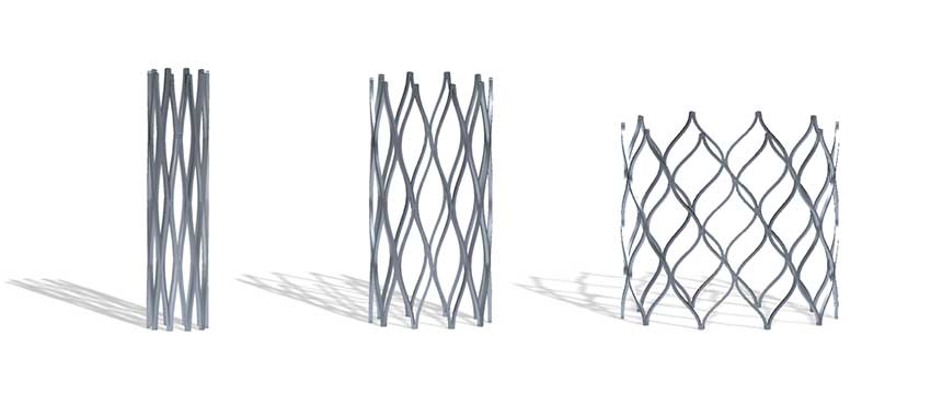 stent-trio-scale.jpg