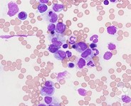 hematology image.jpg