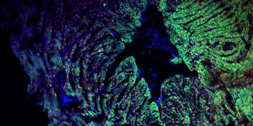 Detailed image of a heart