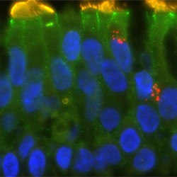 Bronchial cells infected with rhinovirus