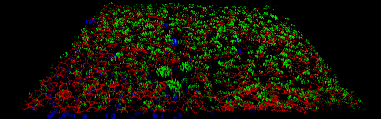 Airway Epithelial Cell