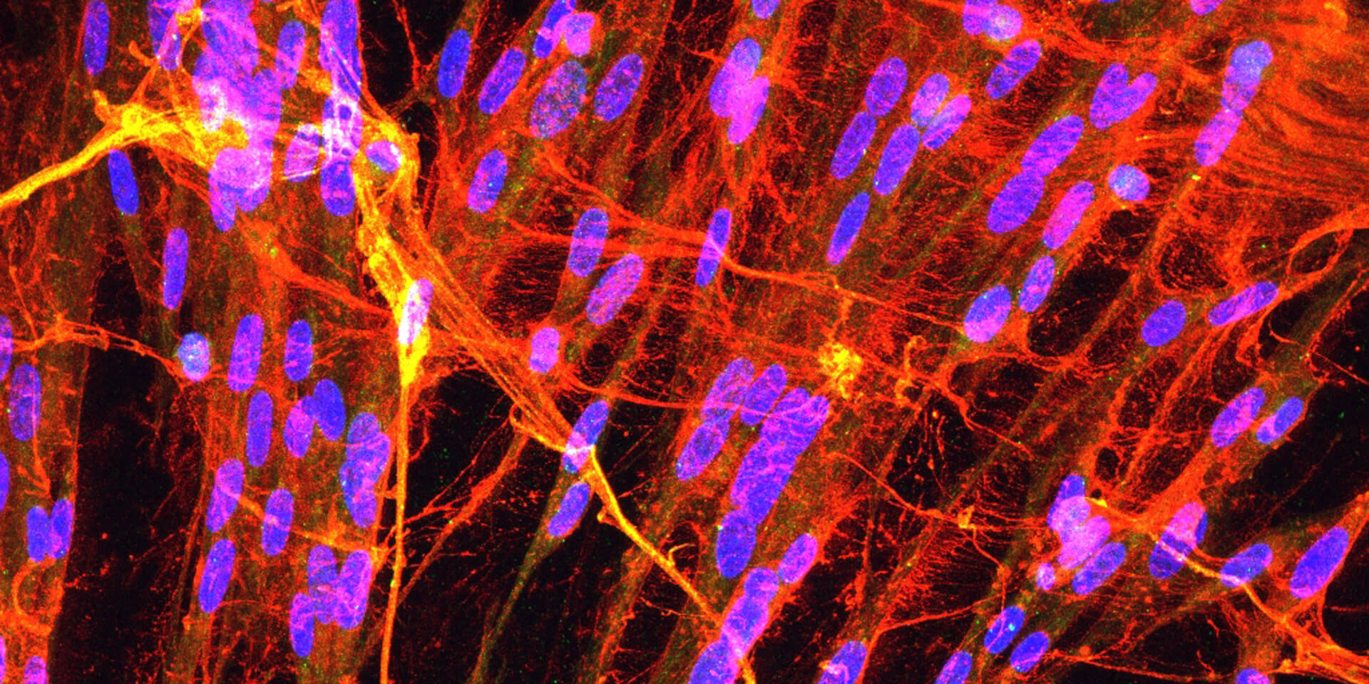 Detail of lung tissue