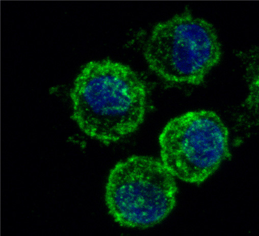 human mast cell