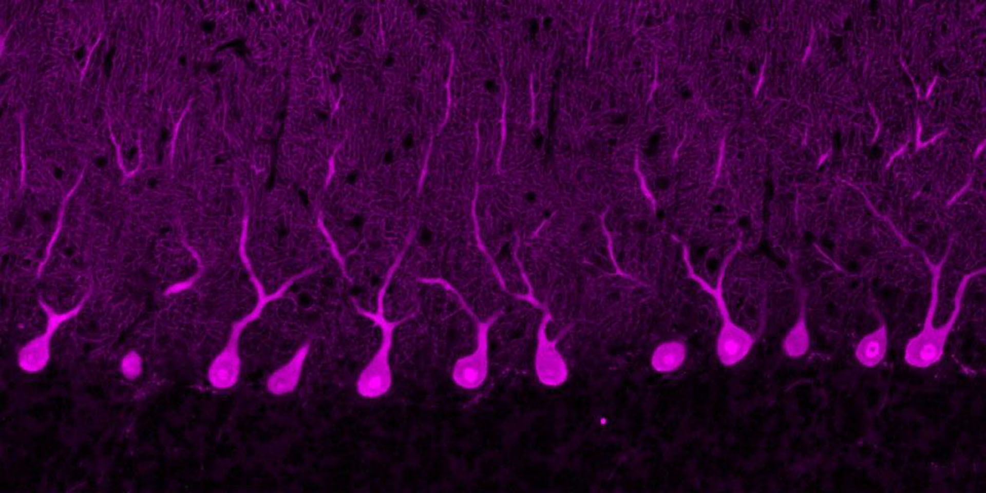 Detail of cerebellum neurons