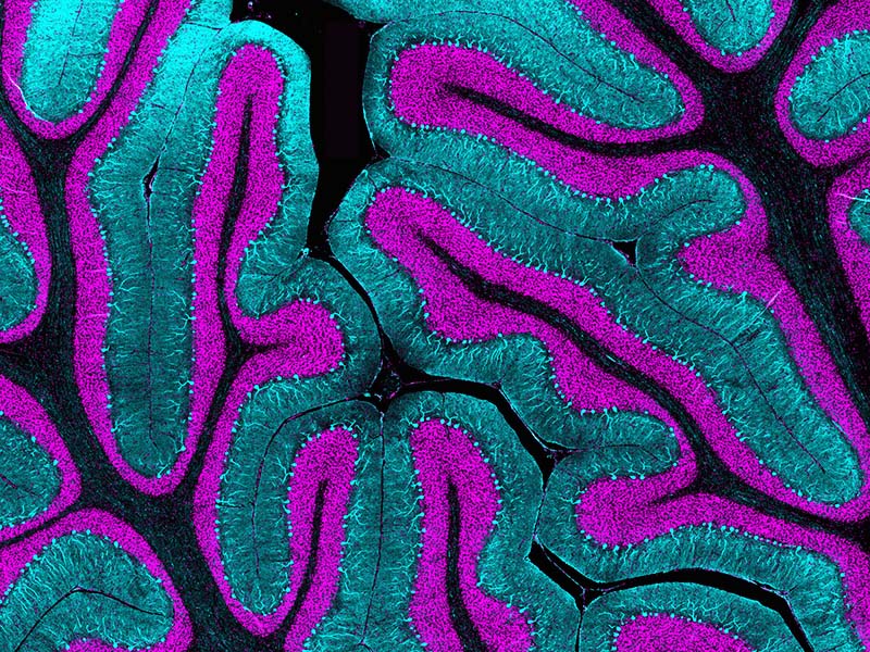 Purkinje cells in the developing human cerebellum at term (37pcw)