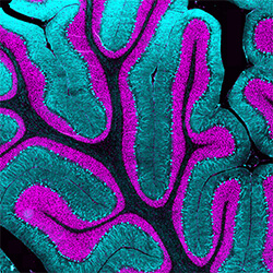 Purkinje cells in the developing human cerebellum at term (37pcw)