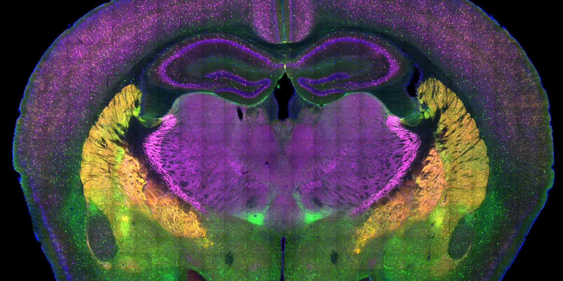 A scan of a brain